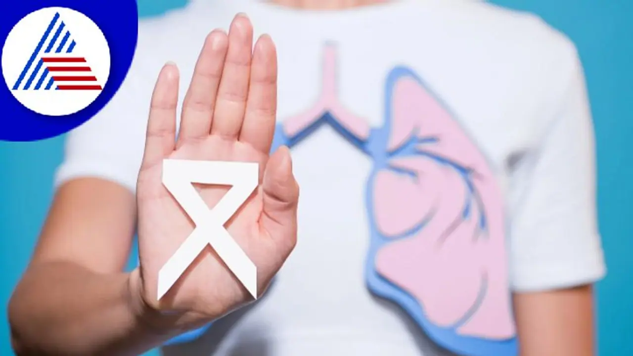 Lung Cancer: Cure rate can be as high as 80% to 90% if detected in early stage