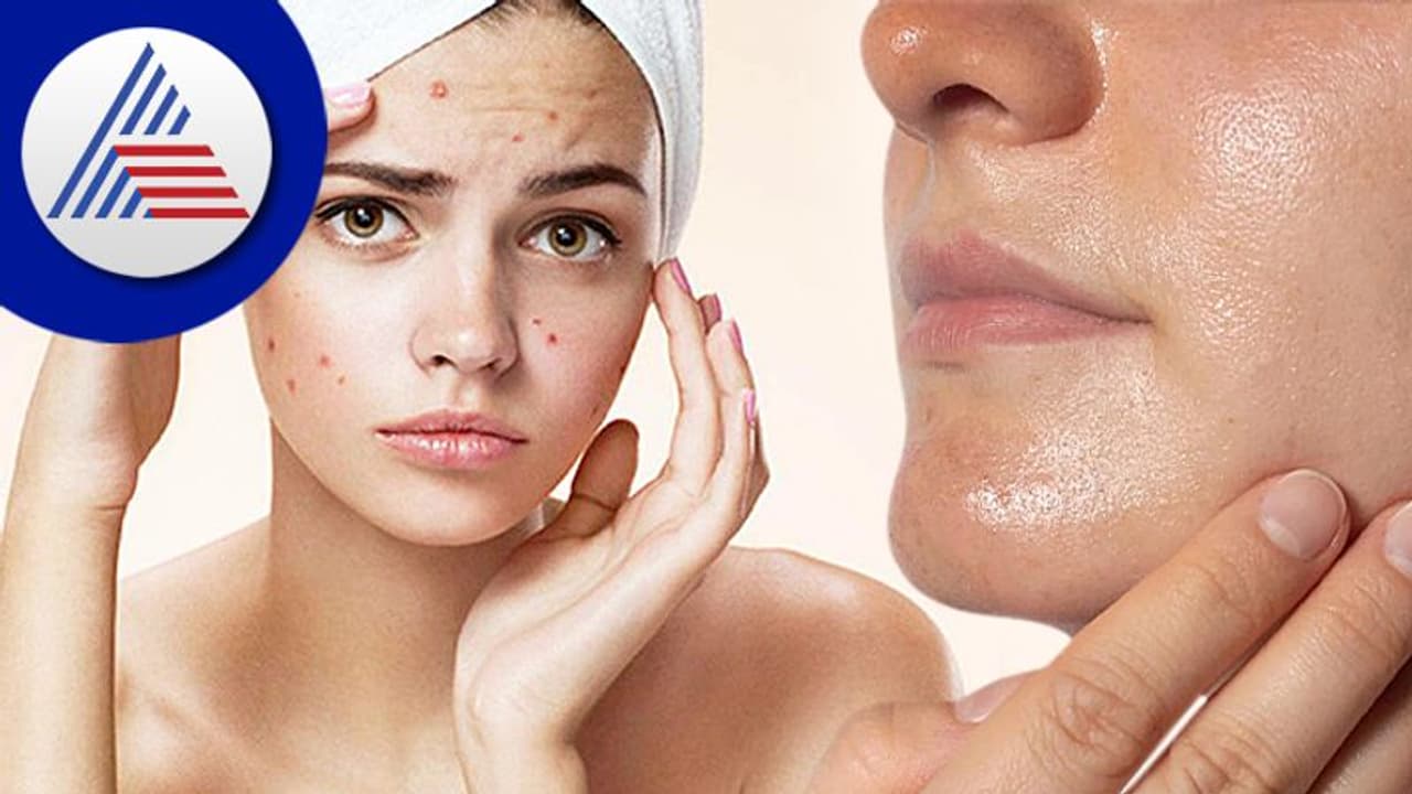 Beauty Tips: ಚರ್ಮದಲ್ಲಿ ಹೀಗಾದರೆ ಹುಷಾರು, ಎಚ್ಚೆತ್ತುಕೊಳ್ಳುವಂತರಾಗಿ!
