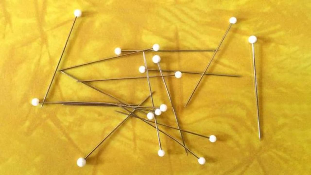 ത്വക്രോഗത്തിന് ആശുപത്രിയിൽ എത്തിയ അഞ്ച് വയസ്സുകാരന്റെ മൂക്കിൽ പിൻ, എട്ട് മാസം മുമ്പ് പോയതെന്ന് ബന്ധുക്കൾ ത്വക്രോഗത്തിന് ആശുപത്രിയിൽ എത്തിയ അഞ്ച് വയസ്സുകാരന്റെ മൂക്കിൽ പിൻ, എട്ട് മാസം മുമ്പ് പോയതെന്ന് ബന്ധുക്കൾ