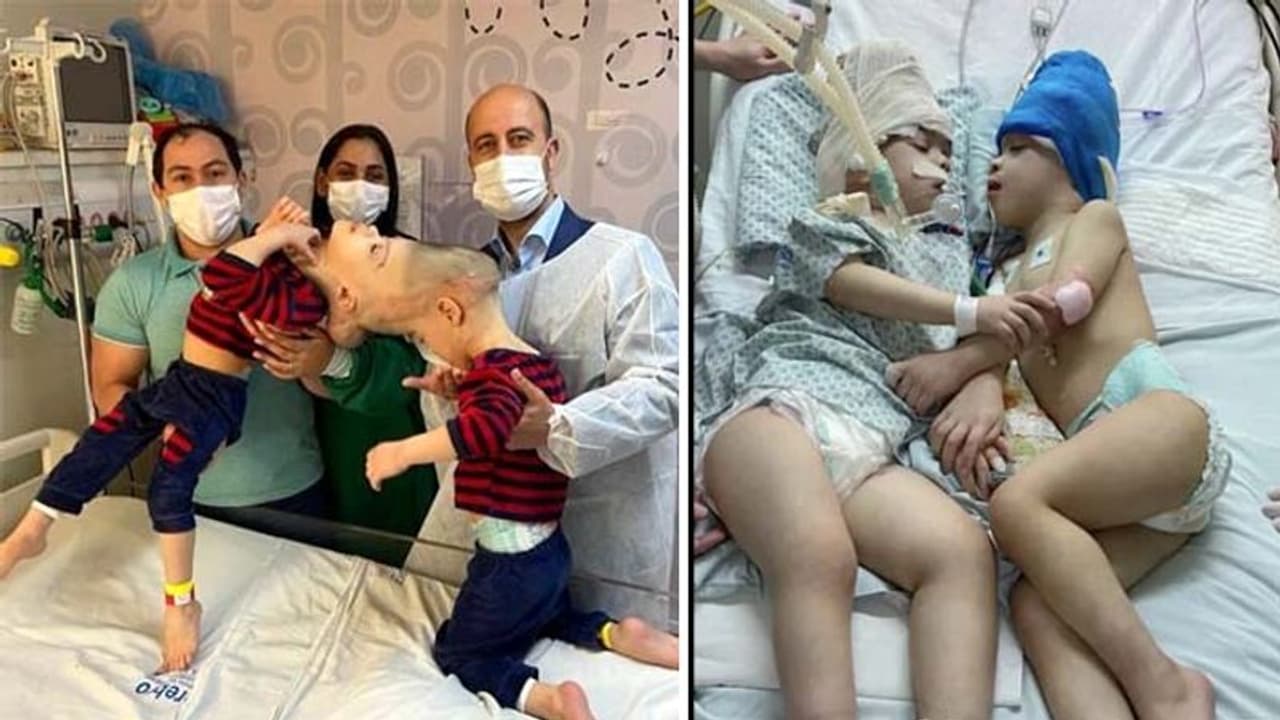 डॉक्टरों की दुनिया में 'हीरो' बना कश्मीर का सुपर सर्जन, इतने जटिल ऑपरेशन करता है कि लोग हैरान रह जाते हैं