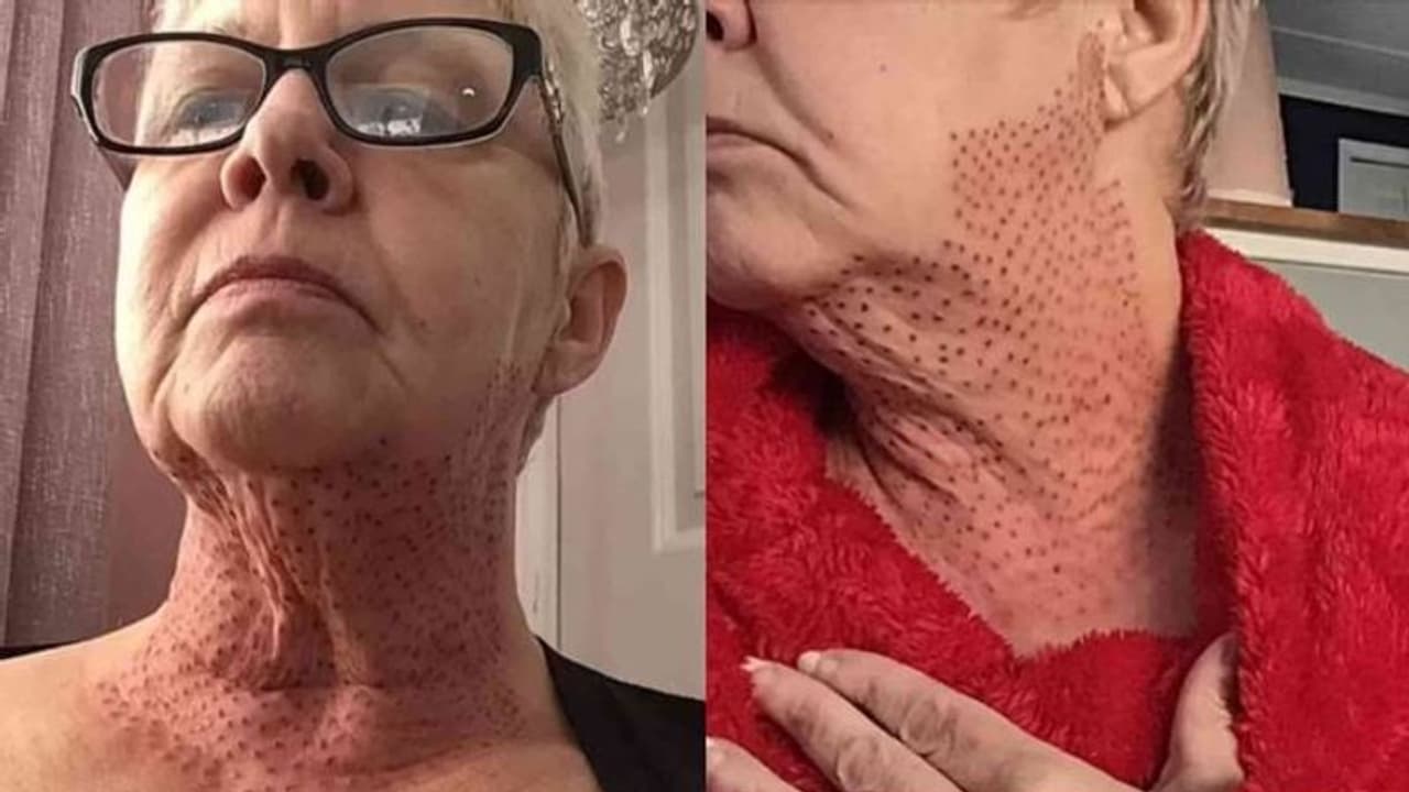 ब्यूटी पॉर्लर में 5 लाख खर्च करने के बाद महिला बन गई 'छिपकली', जानिए आखिर हुआ क्या उसके साथ ब्यूटी पॉर्लर में 5 लाख खर्च करने के बाद महिला बन गई 'छिपकली', जानिए आखिर हुआ क्या उसके साथ