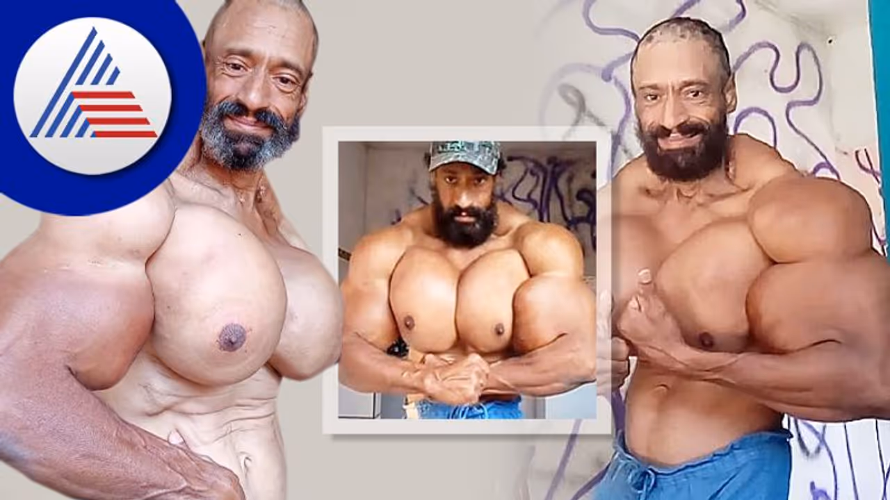 Brazilian Hulk: ಇಂಜೆಕ್ಶನ್ ಬಳಸಿ ಬೈಸೆಪ್ಸ್ ಬೆಳೆಸಿದ್ದ ಬಾಡಿ ಬಿಲ್ಡರ್‌ ಸಾವು