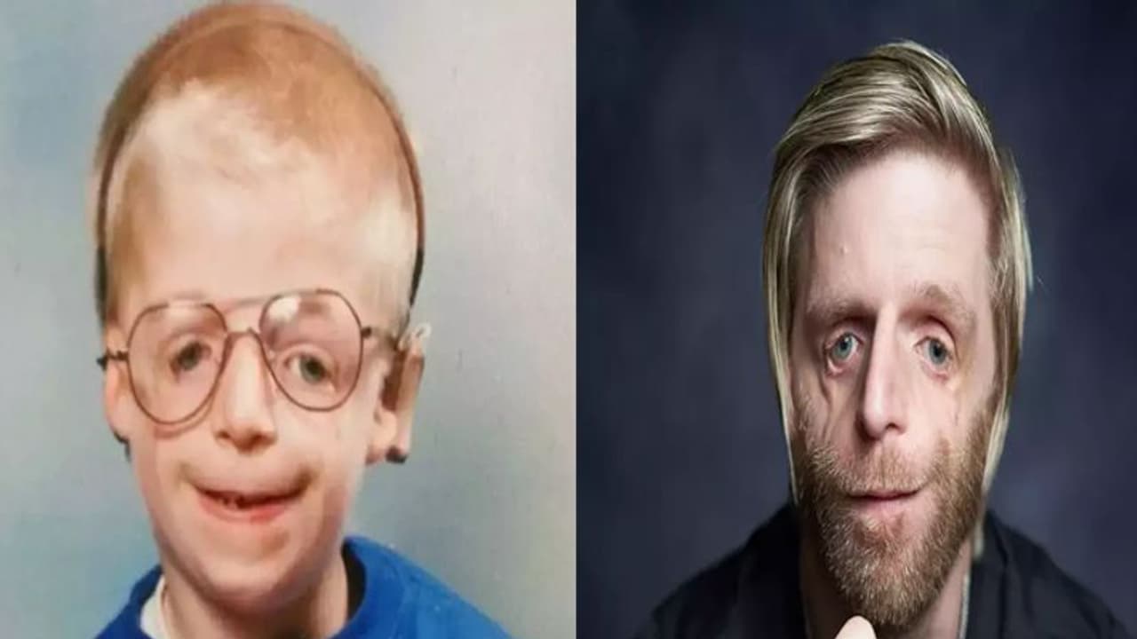 रुला देगी इनकी कहानीः एलियन जैसा चेहरा देख मां बाप ने छोड़ा, 'यशोदा' बन दूसरी मां ने पाला रुला देगी इनकी कहानीः एलियन जैसा चेहरा देख मां बाप ने छोड़ा, 'यशोदा' बन दूसरी मां ने पाला