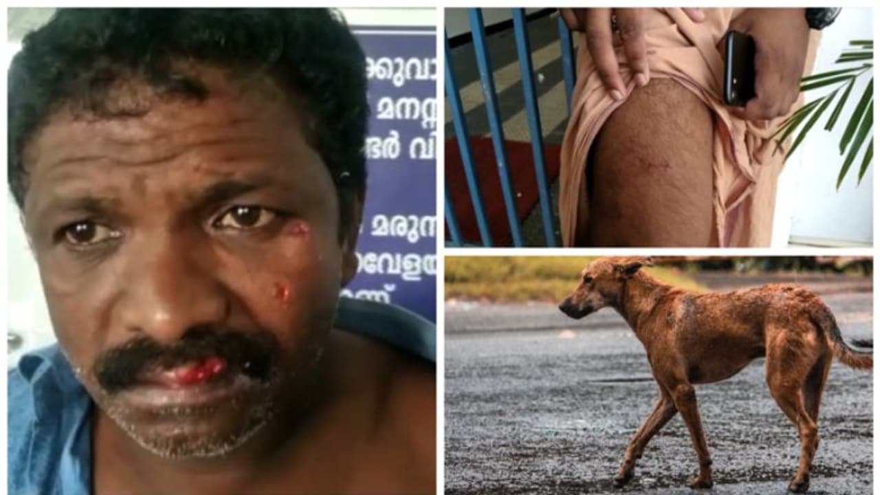 മുഖത്തും വയറിലും കാലിലും കടിയേറ്റു; സഹികെട്ട് ജനം, കോട്ടയത്ത് വീണ്ടും തെരുവുനായ ആക്രമണം; 7 പേര്ക്ക് പരിക്ക് മുഖത്തും വയറിലും കാലിലും കടിയേറ്റു; സഹികെട്ട് ജനം, കോട്ടയത്ത് വീണ്ടും തെരുവുനായ ആക്രമണം; 7 പേര്ക്ക് പരിക്ക്