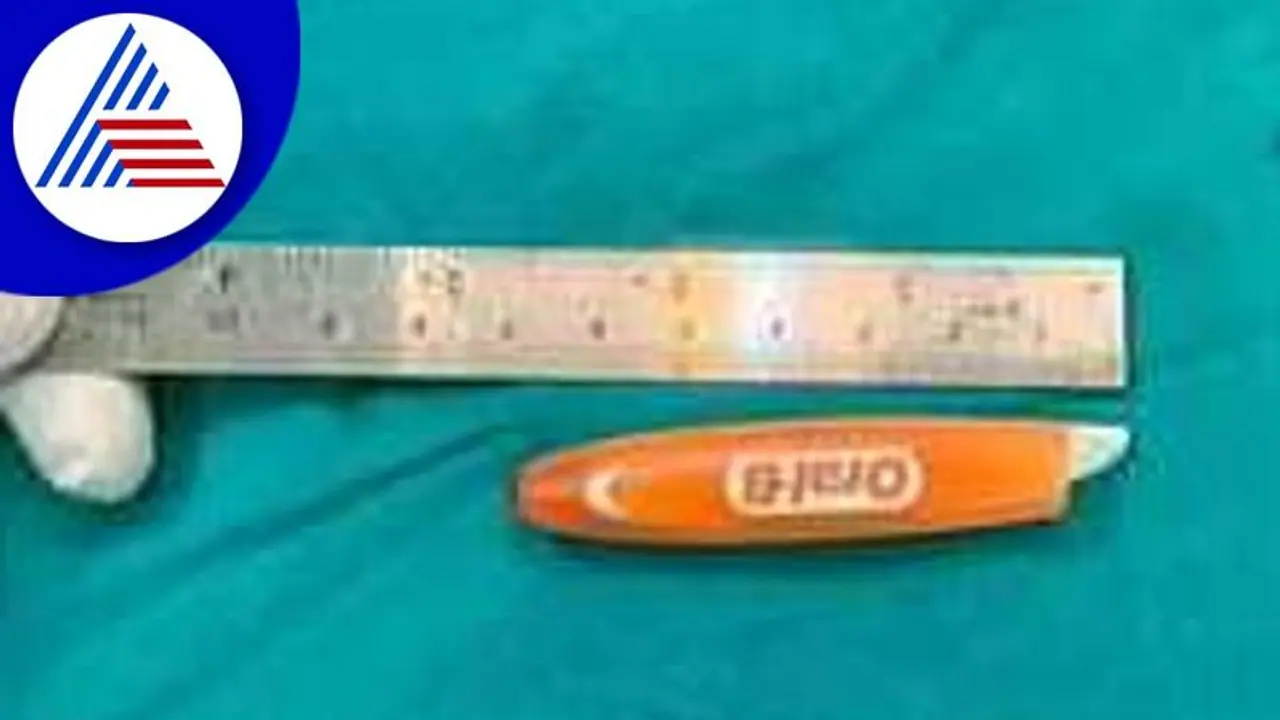 Hubballi: ಮಹಿಳೆಯ ಕಣ್ಣಿನ ಕೆಳಗೆ ಸಿಲುಕಿದ್ದ ಮುರಿದ ಟೂತ್ ಬ್ರಶ್ ಹೊರ ತೆಗೆದ ವೈದ್ಯರು Hubballi: ಮಹಿಳೆಯ ಕಣ್ಣಿನ ಕೆಳಗೆ ಸಿಲುಕಿದ್ದ ಮುರಿದ ಟೂತ್ ಬ್ರಶ್ ಹೊರ ತೆಗೆದ ವೈದ್ಯರು