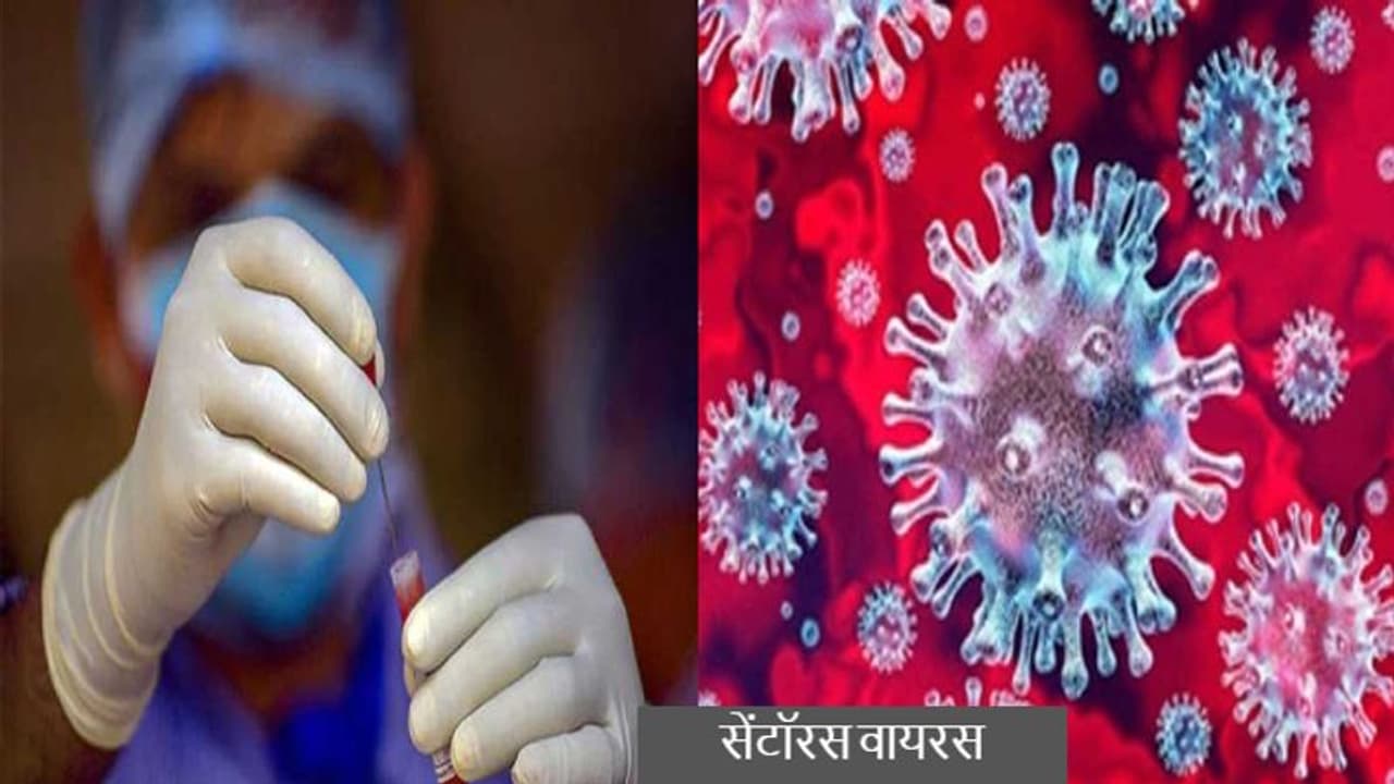 झारखंड में कोरोना की चौथी लहर की आहट, ओमिक्रॉन का सब वैरिएंट सेंटॉरस की पुष्टि झारखंड में कोरोना की चौथी लहर की आहट, ओमिक्रॉन का सब वैरिएंट सेंटॉरस की पुष्टि