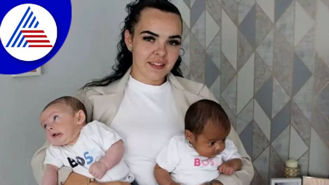 ಅವಳಿ ಮಕ್ಕಳಲ್ಲಿ ಸಾಮ್ಯತೆಯೇ ಇಲ್ಲ, ಕಪ್ಪು, ಬಿಳಿ ಮಗುವಿಗೆ ಜನ್ಮ ನೀಡಿದ ಮಹಿಳೆ ! ಅವಳಿ ಮಕ್ಕಳಲ್ಲಿ ಸಾಮ್ಯತೆಯೇ ಇಲ್ಲ, ಕಪ್ಪು, ಬಿಳಿ ಮಗುವಿಗೆ ಜನ್ಮ ನೀಡಿದ ಮಹಿಳೆ !