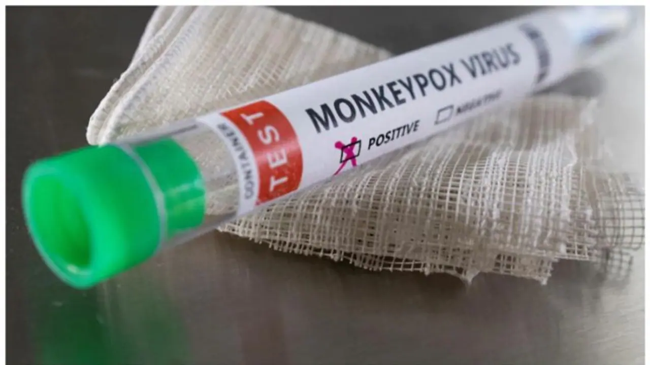 മങ്കിപോക്സ് വൈറസ് വീട്ടുപകരണങ്ങളിൽ ദിവസങ്ങളോളം നിലനിൽക്കാമെന്ന് പഠനം