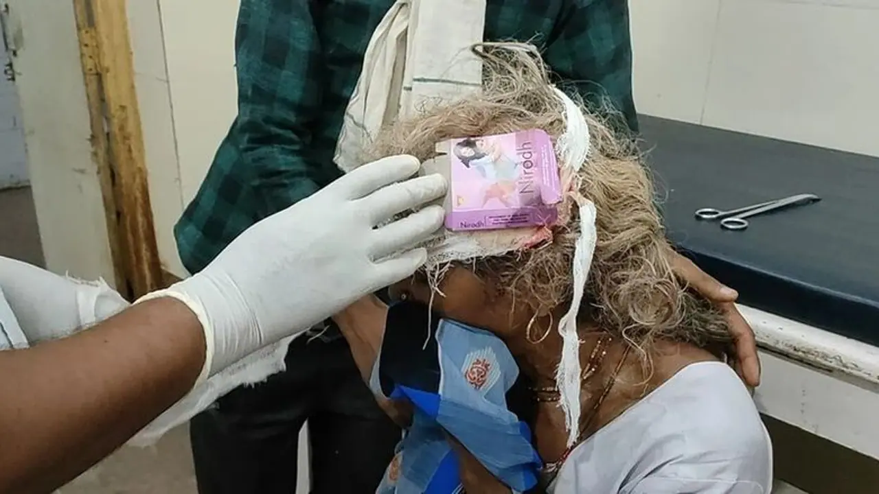 തലയിലെ ബാൻഡേജ് അഴിച്ചപ്പോൾ കണ്ടത് ‘കോണ്ടം പാക്കറ്റ്’; വീഡിയോ കാണാം തലയിലെ ബാൻഡേജ് അഴിച്ചപ്പോൾ കണ്ടത് ‘കോണ്ടം പാക്കറ്റ്’; വീഡിയോ കാണാം