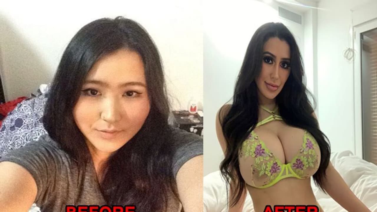 किम कार्दशियन जैसा दिखने के लिए 8 साल में कराई 15 सर्जरी, अब लोग बोलते हैं तुम वो तो नहीं किम कार्दशियन जैसा दिखने के लिए 8 साल में कराई 15 सर्जरी, अब लोग बोलते हैं तुम वो तो नहीं