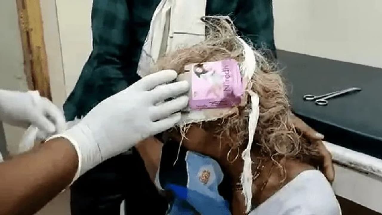 MP का शर्मनाक कांड: इलाज के लिए गई महिला के सिर पर लगाया कंडोम रैपर, होश उड़ा देगी घटना...देखिए वीडियो MP का शर्मनाक कांड: इलाज के लिए गई महिला के सिर पर लगाया कंडोम रैपर, होश उड़ा देगी घटना...देखिए वीडियो