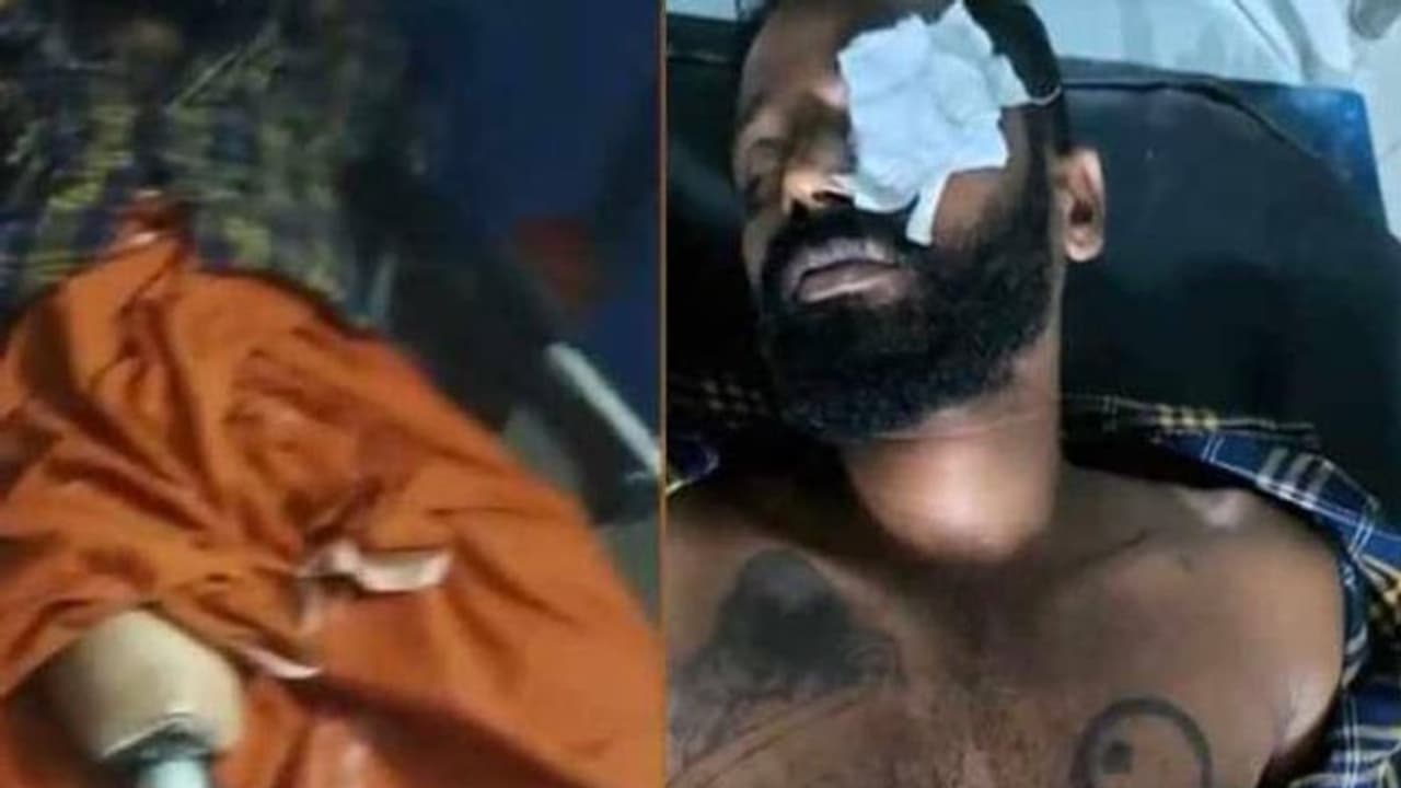 പൊലീസ് മുഖത്തടിച്ചു, മുതുകത്ത് ചുറ്റിക കൊണ്ട് ഇടിച്ചു, വാരിയെല്ല് പൊട്ടി; പരാതിയുമായി ഭിന്നശേഷിക്കാരൻ പൊലീസ് മുഖത്തടിച്ചു, മുതുകത്ത് ചുറ്റിക കൊണ്ട് ഇടിച്ചു, വാരിയെല്ല് പൊട്ടി; പരാതിയുമായി ഭിന്നശേഷിക്കാരൻ