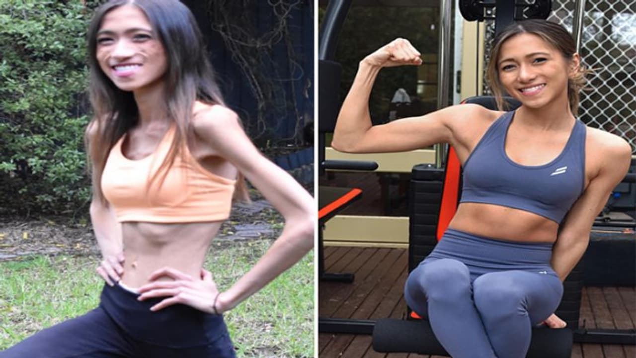 मॉडल बनने के लिए लड़की ने Weight loss का अपनाया ऐसा तरीका, दिखने लगी कंकाल जैसी, ना करें ऐसी भूल मॉडल बनने के लिए लड़की ने Weight loss का अपनाया ऐसा तरीका, दिखने लगी कंकाल जैसी, ना करें ऐसी भूल