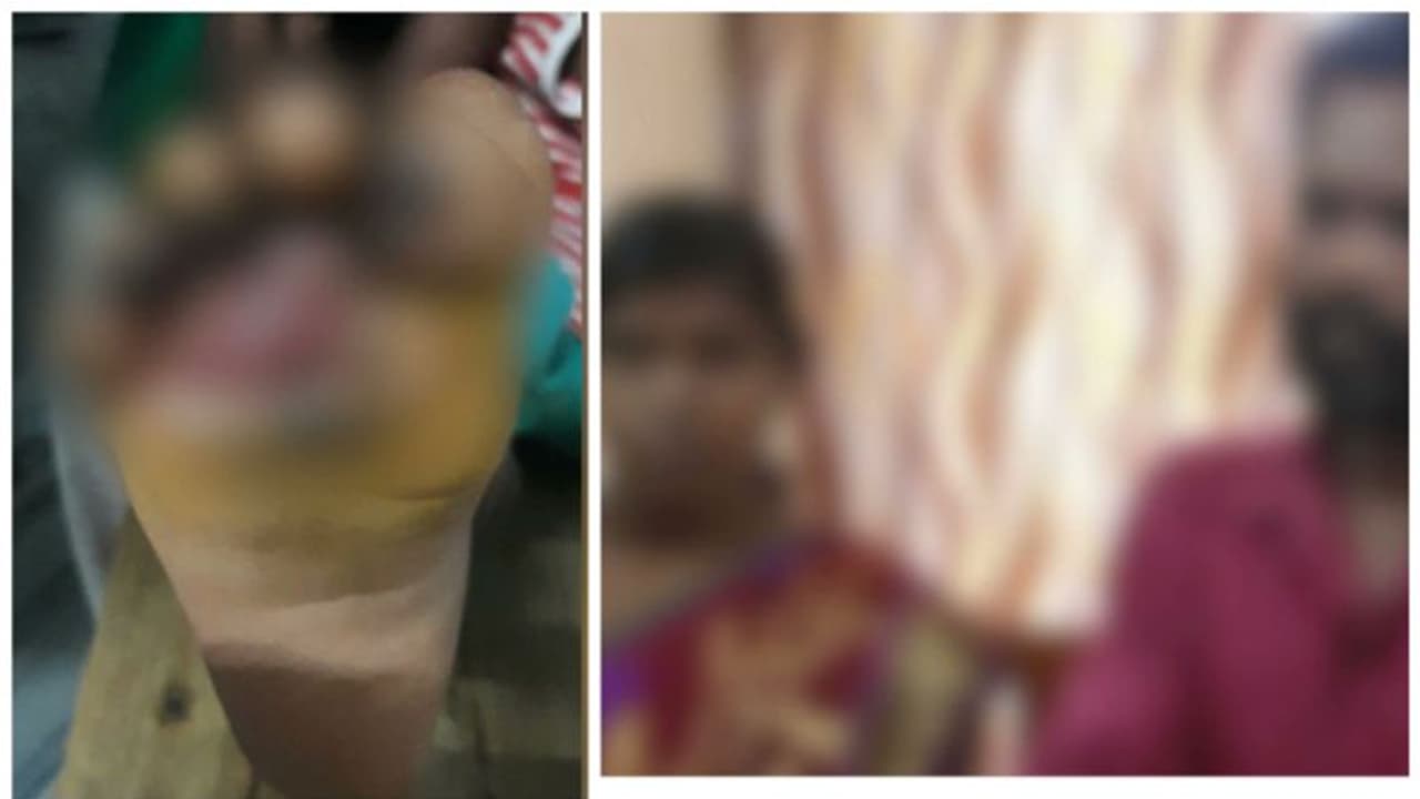 നാല് വയസുകാരന്റെ കാൽ സ്റ്റൌവിൽവെച്ച് പൊള്ളിച്ചു, ക്രൂരമർദ്ദനം; അമ്മയും ആൺസുഹൃത്തും പിടിയിൽ; കുട്ടി ചികിത്സയിൽ 