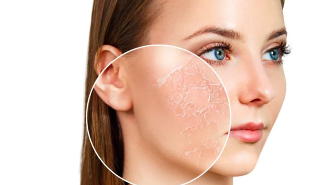 Dry Skin: വരണ്ട ചര്‍മ്മമുള്ളവര്‍ ഡയറ്റില്‍ ഉള്‍പ്പെടുത്തേണ്ട ഭക്ഷണങ്ങള്‍...