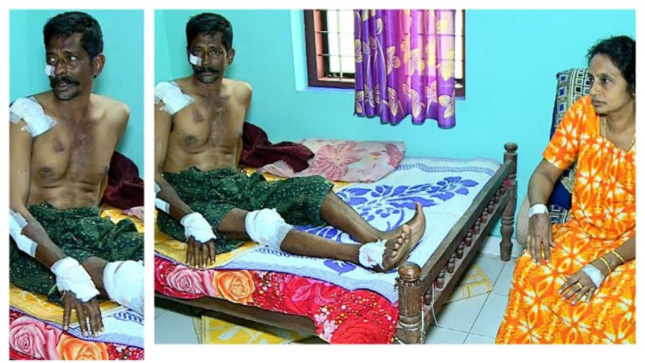 മരണക്കെണിയായി കുഴി; റോഡിലെ കുഴിയിൽ വീണ് സ്കൂട്ടർ യാത്രികരായ ദമ്പതികൾക്ക് പരിക്ക് മരണക്കെണിയായി കുഴി; റോഡിലെ കുഴിയിൽ വീണ് സ്കൂട്ടർ യാത്രികരായ ദമ്പതികൾക്ക് പരിക്ക്