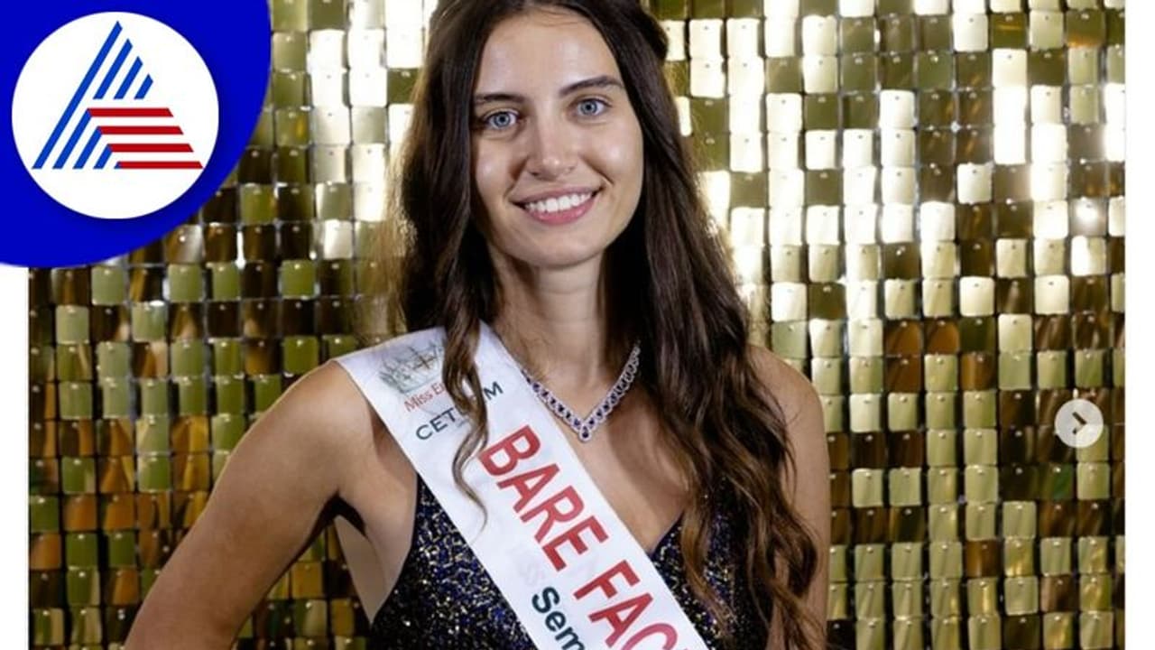 Miss England Beauty Pageant: ಮೇಕಪ್ ಇಲ್ಲದೇ ಸ್ಪರ್ಧಿಸಿ ತೀರ್ಪುಗಾರರ ಮನಗೆದ್ದ ಮೆಲಿಸಾ