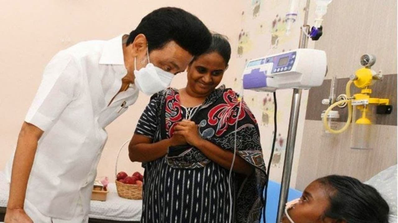 முகச்சிதைவால் பாதிக்கப்பட்டு சிகிச்சை பெறும் சிறுமி... நேரில் சென்று நலம் விசாரித்த மு.க.ஸ்டாலின்!!