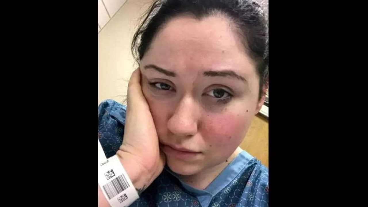 വിചിത്രമായ അലര്‍ജിയുമായി ഇരുപത്തിയെട്ടുകാരി; 3 മിനുറ്റിലധികം നില്‍ക്കാൻ സാധിക്കില്ല