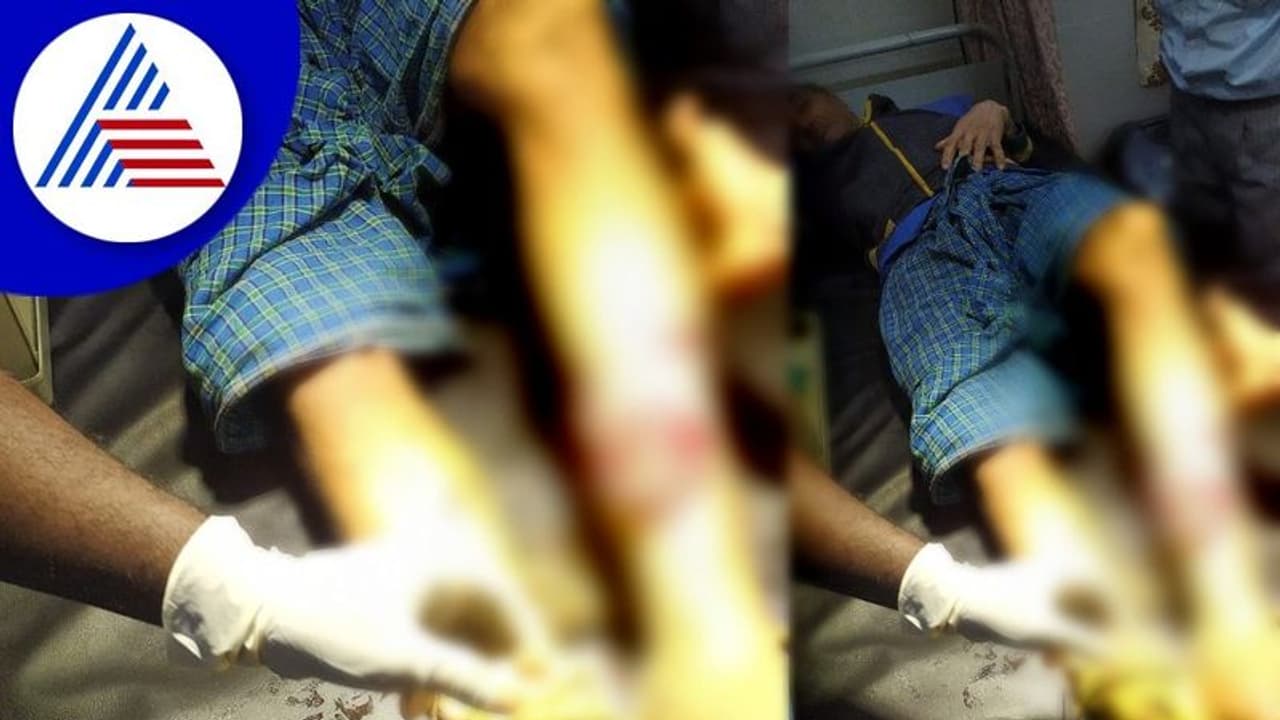 Chikkamagaluru: ತೋಟದಲ್ಲಿ ಕೆಲಸ ಮಾಡುವಾಗ ಕಾರ್ಮಿಕನ ಮೇಲೆ ಕರಡಿ ದಾಳಿ: ಗಂಭೀರ ಗಾಯ Chikkamagaluru: ತೋಟದಲ್ಲಿ ಕೆಲಸ ಮಾಡುವಾಗ ಕಾರ್ಮಿಕನ ಮೇಲೆ ಕರಡಿ ದಾಳಿ: ಗಂಭೀರ ಗಾಯ