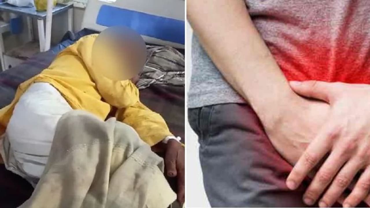 சிறுநீர் கழிக்கும் போது ஏற்பட்ட வயிற்று வலி.. ஆணுறுப்பை வெட்டிய அதிர்ச்சி சம்பவம் !