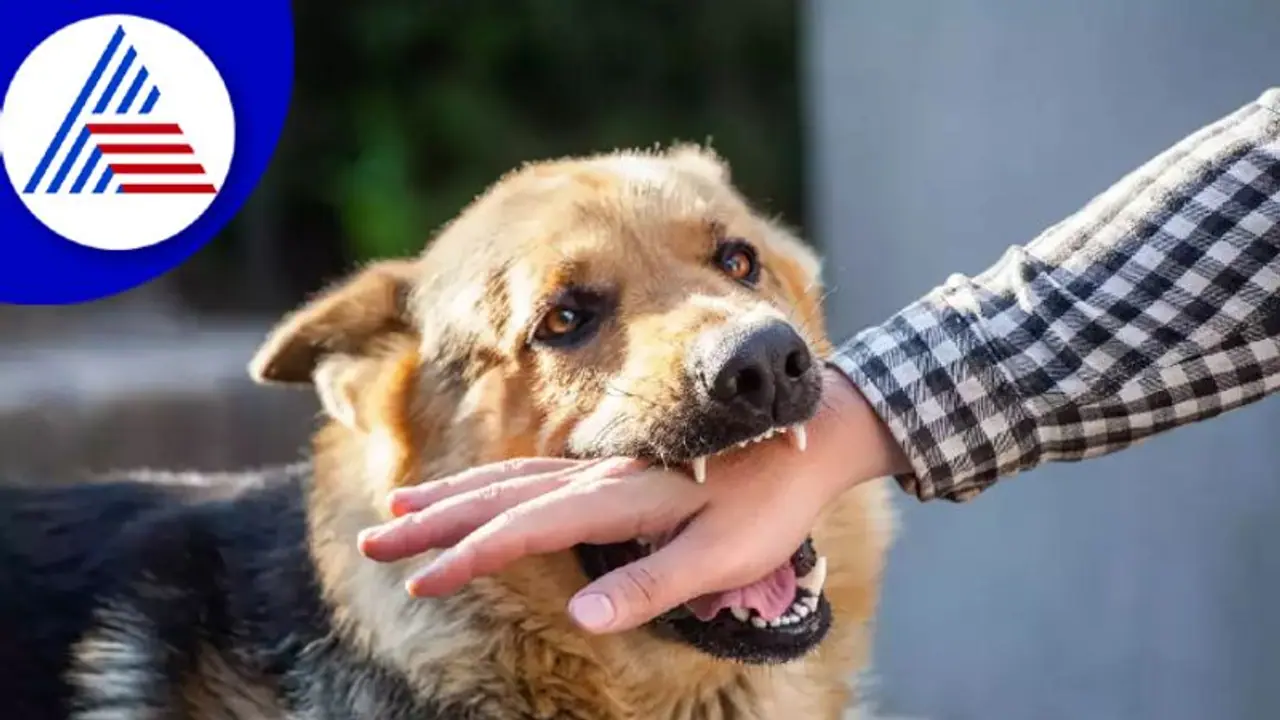 ನಾಯಿ ಕಚ್ಚಿದಾಗ ತಕ್ಷಣ ಕ್ರಮ ತಗೊಳ್ಳಿ, ಇಲ್ಲಾಂದ್ರೆ ರೇಬೀಸ್ ಬರೋದು ಗ್ಯಾರಂಟಿ ! ನಾಯಿ ಕಚ್ಚಿದಾಗ ತಕ್ಷಣ ಕ್ರಮ ತಗೊಳ್ಳಿ, ಇಲ್ಲಾಂದ್ರೆ ರೇಬೀಸ್ ಬರೋದು ಗ್ಯಾರಂಟಿ !