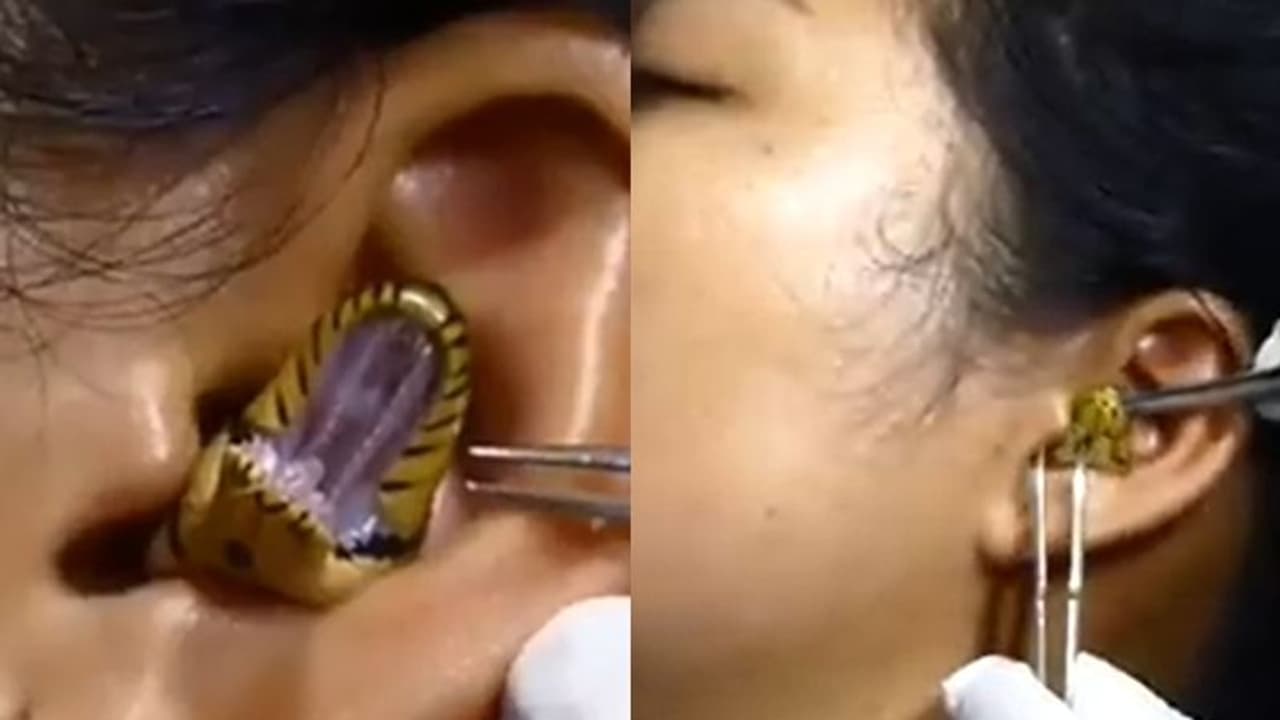 பெண்ணின் காதுக்குள் புகுந்த பாம்பு... அடுத்து நிகழ்ந்தது என்ன? அதிர்ச்சியை ஏற்படுத்தும் வீடியோ!! பெண்ணின் காதுக்குள் புகுந்த பாம்பு... அடுத்து நிகழ்ந்தது என்ன? அதிர்ச்சியை ஏற்படுத்தும் வீடியோ!!