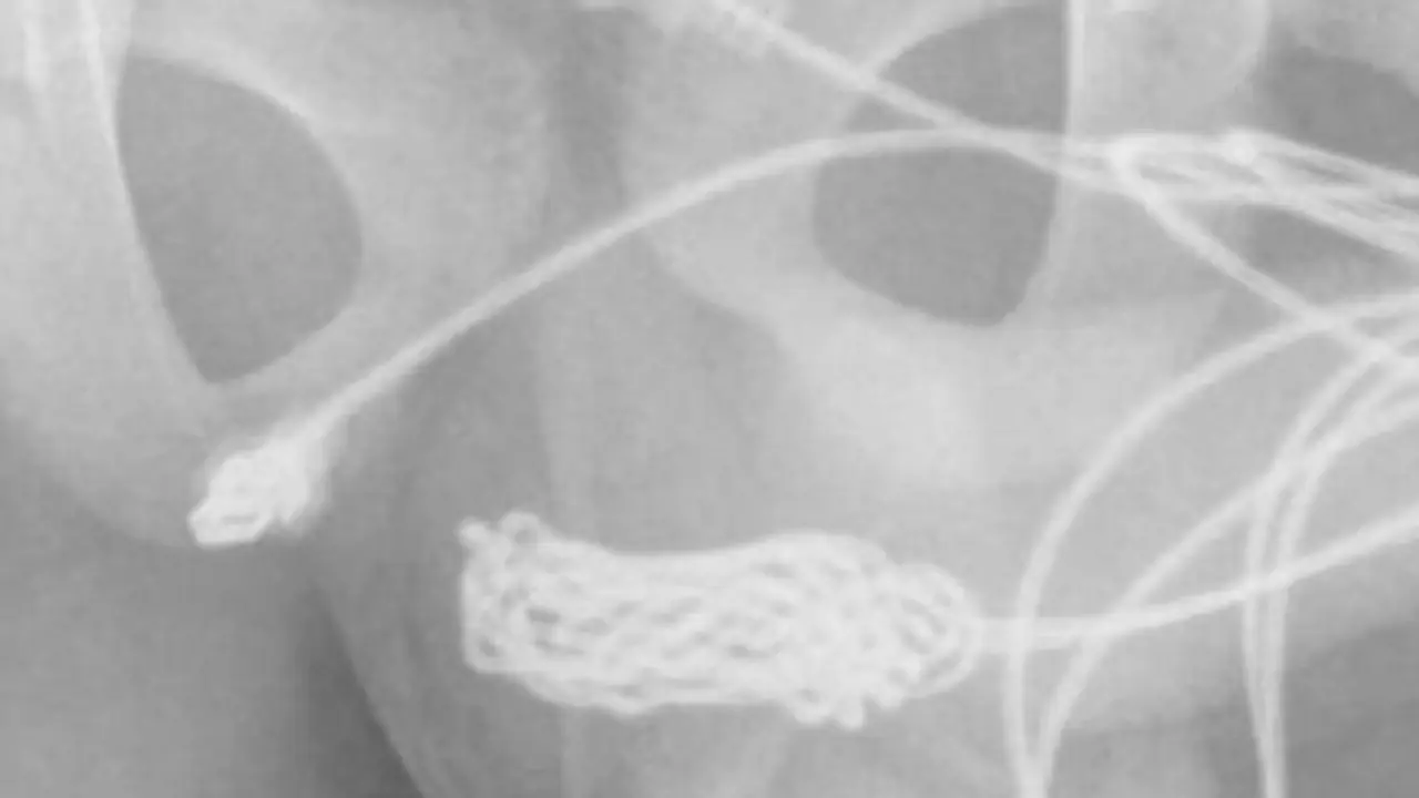 ஆணுறுப்பின் சைஸை அளக்க USB கேபிளை உள்ளே சொருகிய சிறுவன்.. இறுதியில் என்ன நடந்தது தெரியுமா? ஆணுறுப்பின் சைஸை அளக்க USB கேபிளை உள்ளே சொருகிய சிறுவன்.. இறுதியில் என்ன நடந்தது தெரியுமா?