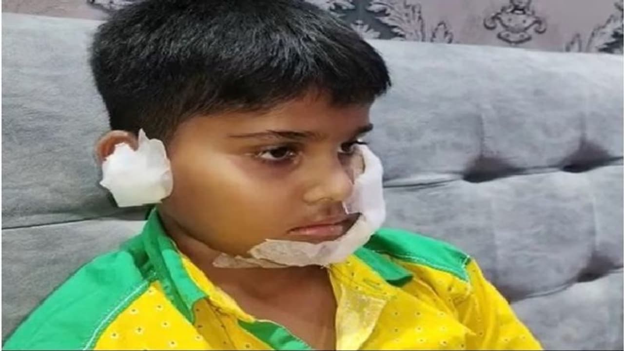 गाजियाबाद: पार्क में खेल रहे 10 साल के बच्चे पर पिटबुल ने किया हमला, 150 टांके, सीसीटीवी वीडियो आया सामने गाजियाबाद: पार्क में खेल रहे 10 साल के बच्चे पर पिटबुल ने किया हमला, 150 टांके, सीसीटीवी वीडियो आया सामने