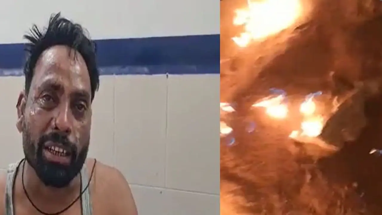 युवक को जिंदा जलाकर मारने की कोशिश, दो लोगों के विवाद का कर रहा था निपटारा