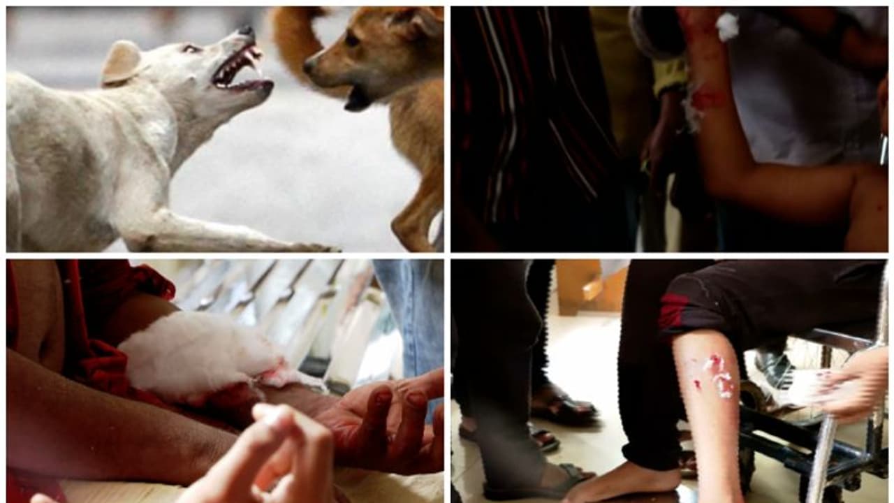 കോഴിക്കോട്ട് രണ്ട് കുട്ടികളടക്കം മൂന്ന് പേര്ക്ക് തെരുവുനായയുടെ കടിയേറ്റു കോഴിക്കോട്ട് രണ്ട് കുട്ടികളടക്കം മൂന്ന് പേര്ക്ക് തെരുവുനായയുടെ കടിയേറ്റു