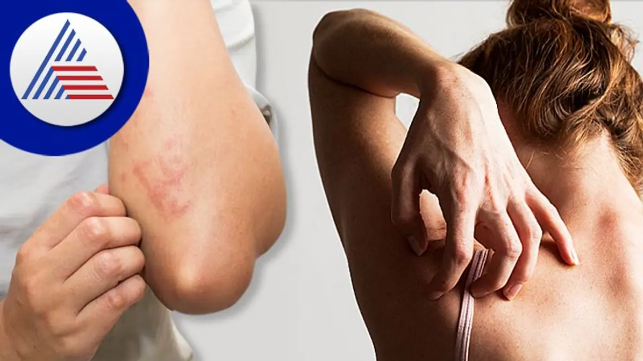 சருமத்தில் அரிப்பு தோன்றினால் லேசாக எடுத்துவிட வேண்டும் புற்றுநோய் பாதிப்பாக இருக்கலாம்..!!