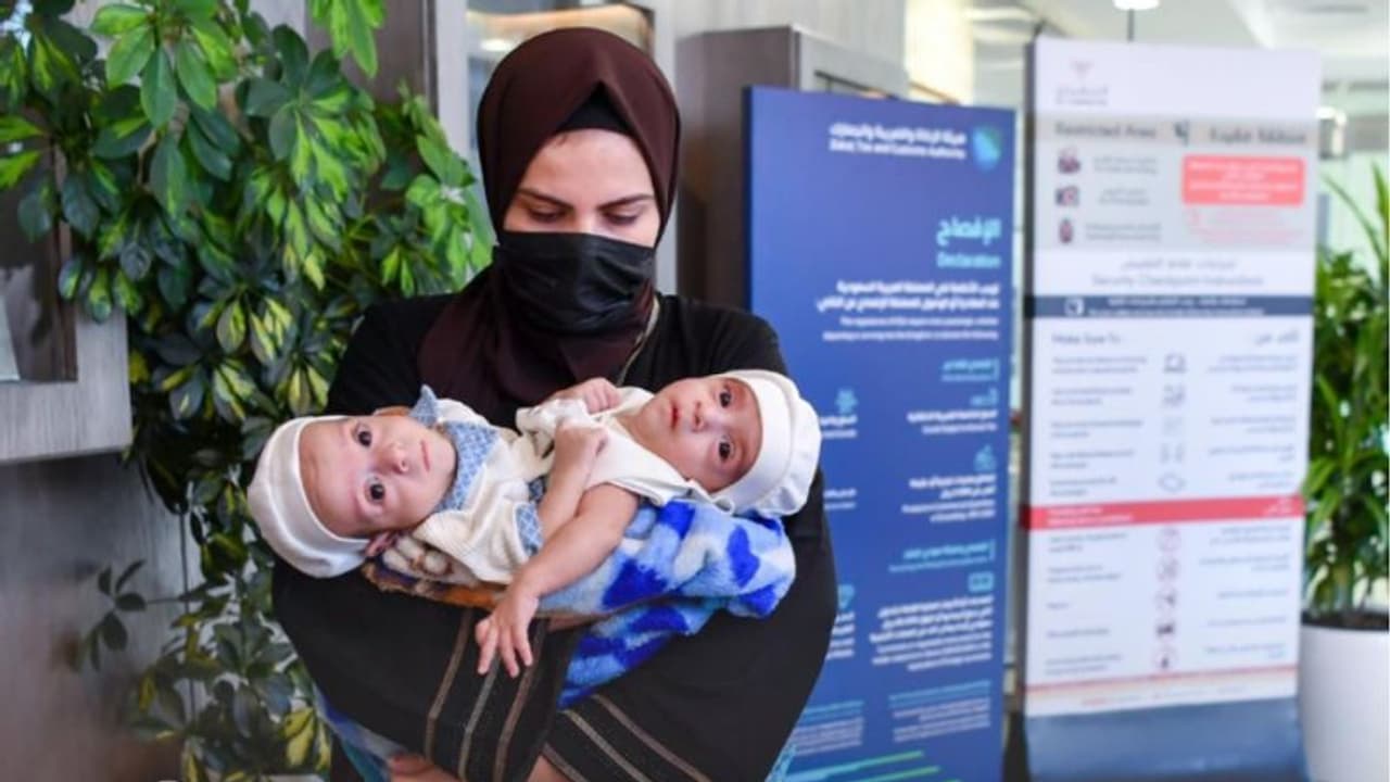 വേർപ്പെടുത്തൽ ശസ്ത്രക്രിയയുടെ സാധ്യത പരിശോധിക്കാന് ഇറാഖി സയാമീസ് ഇരട്ടകളെ സൗദി അറേബ്യയിലെത്തിച്ചു വേർപ്പെടുത്തൽ ശസ്ത്രക്രിയയുടെ സാധ്യത പരിശോധിക്കാന് ഇറാഖി സയാമീസ് ഇരട്ടകളെ സൗദി അറേബ്യയിലെത്തിച്ചു