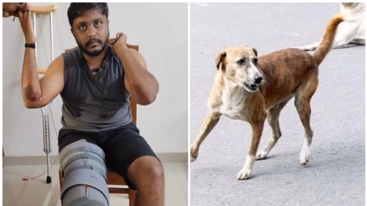 സ്കൂട്ടറിന് കുറുകെ തെരുവ് നായ ചാടി, യുവ അഭിഭാഷകന് പരിക്ക് സ്കൂട്ടറിന് കുറുകെ തെരുവ് നായ ചാടി, യുവ അഭിഭാഷകന് പരിക്ക്