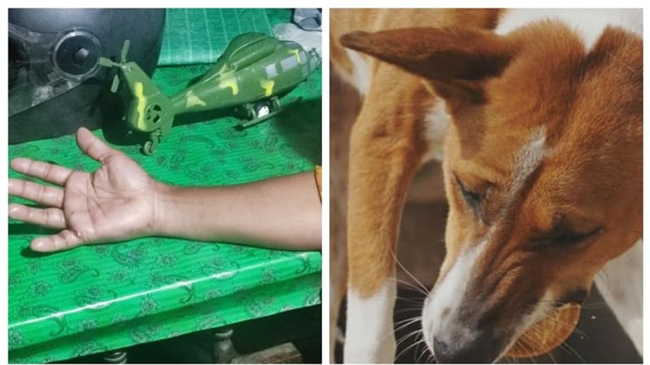 തൃശ്ശൂരില്‍ വീട്ടുമുറ്റത്ത് പാത്രം കഴുകികൊണ്ടിരുന്ന സ്ത്രീക്ക് തെരുവുനായയുടെ കടിയേറ്റു