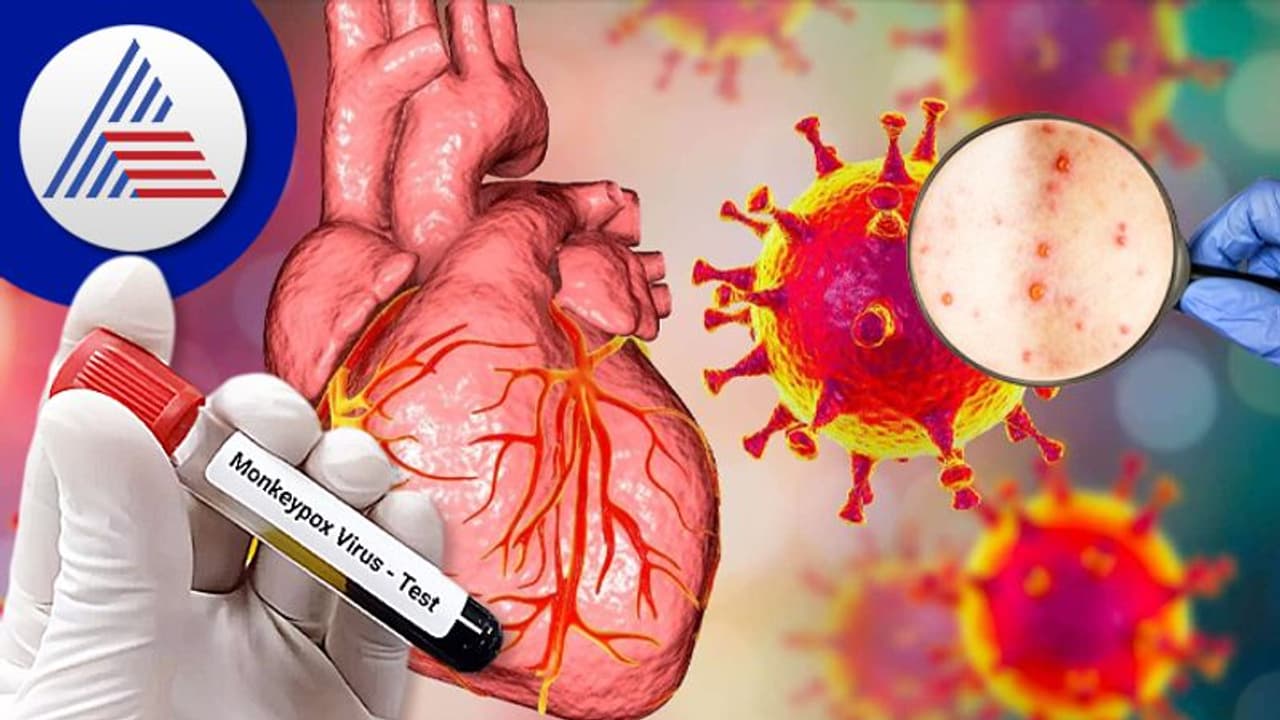 ಹರಡ್ತಿದೆ ಮಂಕಿಪಾಕ್ಸ್ ಸೋಂಕು, ಹೃದಯದ ಕಾಯಿಲೆಗೂ ಕಾರಣವಾಗುತ್ತಂತೆ ! ಹರಡ್ತಿದೆ ಮಂಕಿಪಾಕ್ಸ್ ಸೋಂಕು, ಹೃದಯದ ಕಾಯಿಲೆಗೂ ಕಾರಣವಾಗುತ್ತಂತೆ !