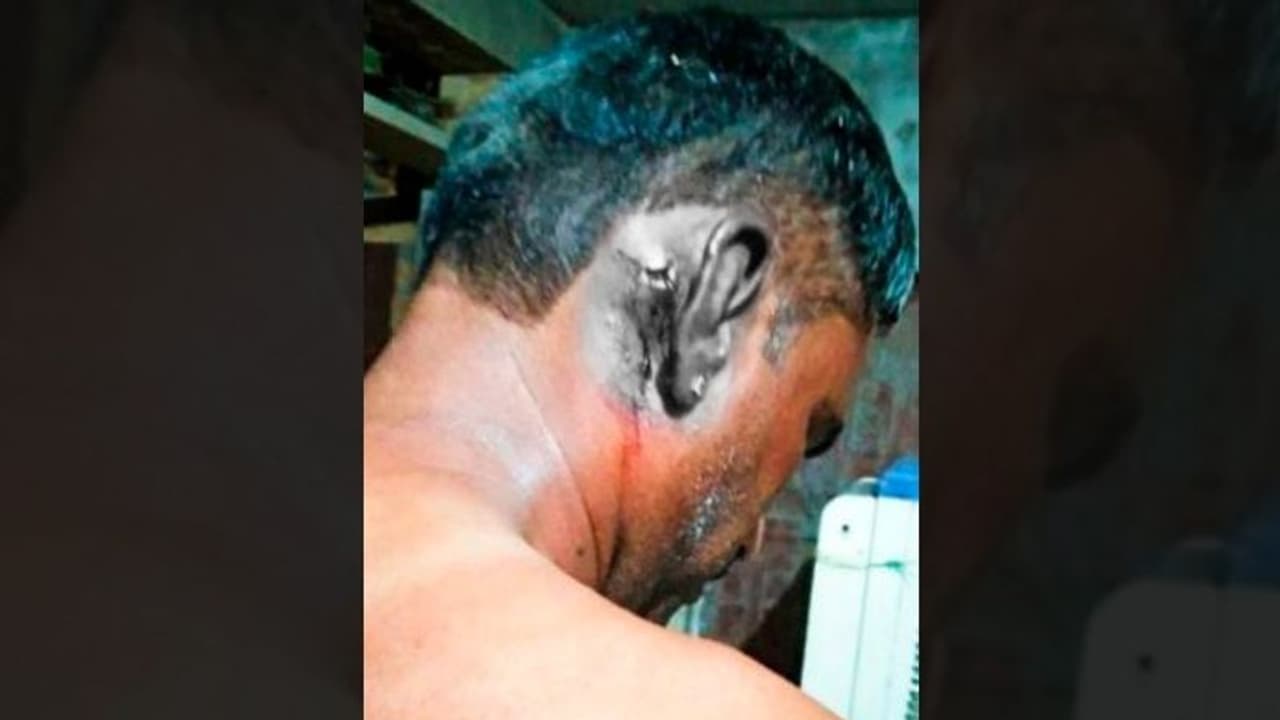 राजस्थान में दलित व्यक्ति को मटके से पानी पीना पड़ा भारी, दबंगों ने लाठी रॉड से हमला कर बिगाड़ दिया हुलिया राजस्थान में दलित व्यक्ति को मटके से पानी पीना पड़ा भारी, दबंगों ने लाठी रॉड से हमला कर बिगाड़ दिया हुलिया