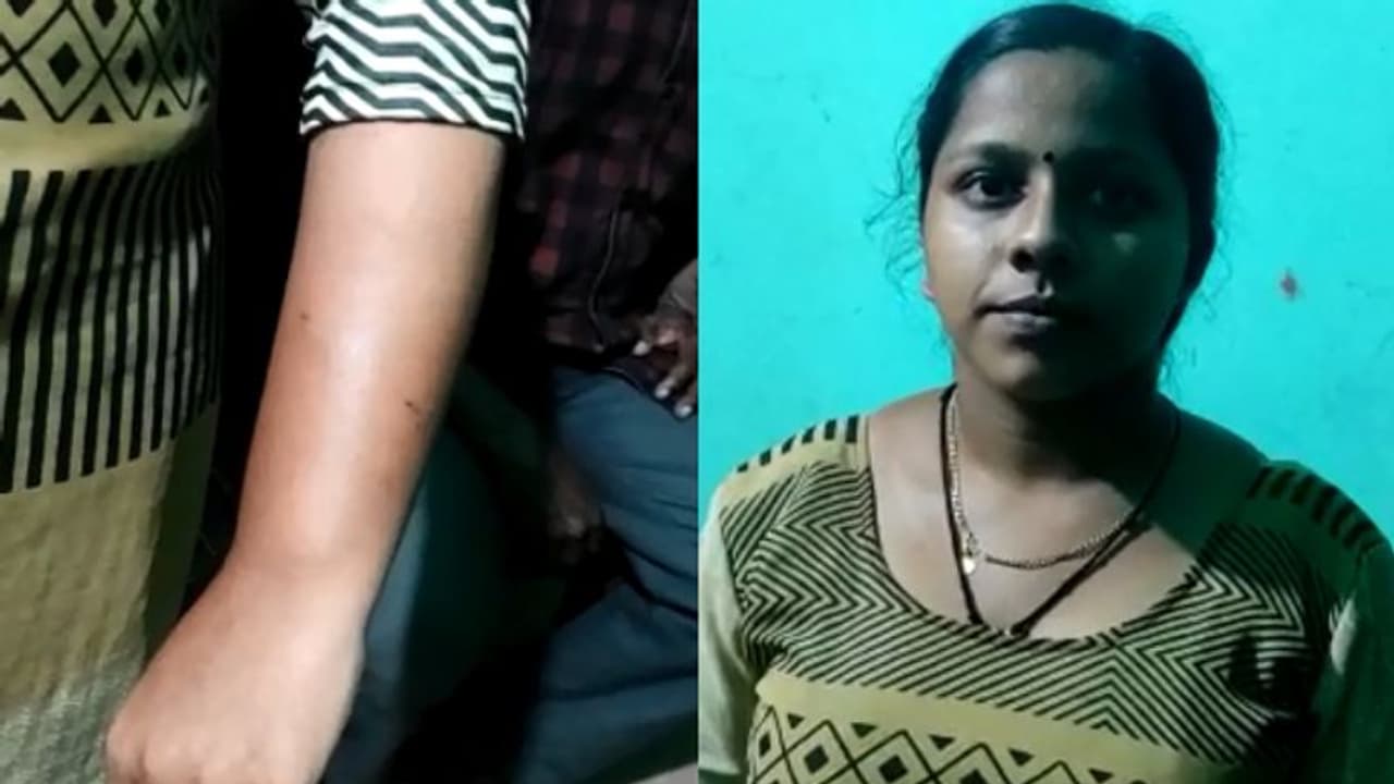 മുറിയില് ഉറങ്ങുകയായിരുന്ന വിദ്യാര്ഥിനിയെ തെരുവ് നായ കടിച്ചു മുറിയില് ഉറങ്ങുകയായിരുന്ന വിദ്യാര്ഥിനിയെ തെരുവ് നായ കടിച്ചു