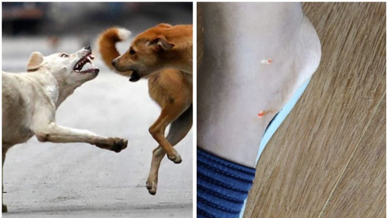 വിദ്യാർത്ഥിക്ക് തെരുവുനായയുടെ കടിയേറ്റു, ആക്രമിച്ചത് സ്കൂളിലേക്ക് പോകുന്നവഴിയിൽവെച്ച് വിദ്യാർത്ഥിക്ക് തെരുവുനായയുടെ കടിയേറ്റു, ആക്രമിച്ചത് സ്കൂളിലേക്ക് പോകുന്നവഴിയിൽവെച്ച്