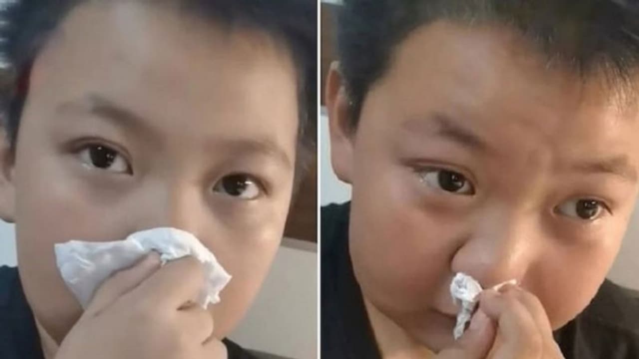 'പുസ്തകങ്ങളുടെ മണം അലർജി, ഹോംവര്‍ക്ക് ചെയ്യാന്‍ പറ്റില്ല'; വൈറലായി കുറുമ്പന്‍റെ അസുഖം