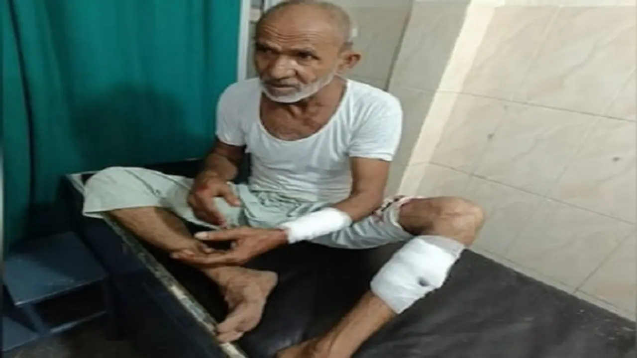 नोएडा में मॉर्निंग वॉक पर निकले 60 साल के बुजुर्ग पर आवारा कुत्ते ने किया हमला, इलाज के दौरान लगे इतने टांके