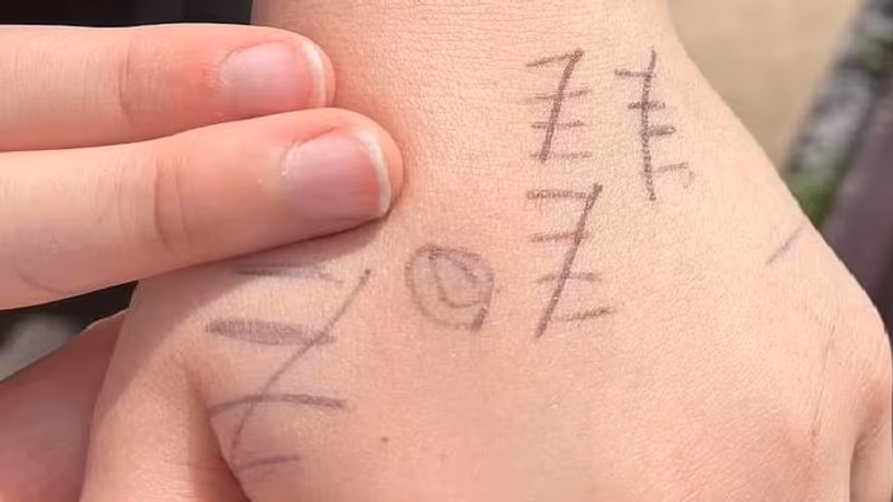 മകന്റെ കയ്യിൽ പേന കൊണ്ടുള്ള വരകൾ, അർത്ഥം മനസിലാക്കിയപ്പോൾ തകർന്നുപോയി അച്ഛൻ മകന്റെ കയ്യിൽ പേന കൊണ്ടുള്ള വരകൾ, അർത്ഥം മനസിലാക്കിയപ്പോൾ തകർന്നുപോയി അച്ഛൻ