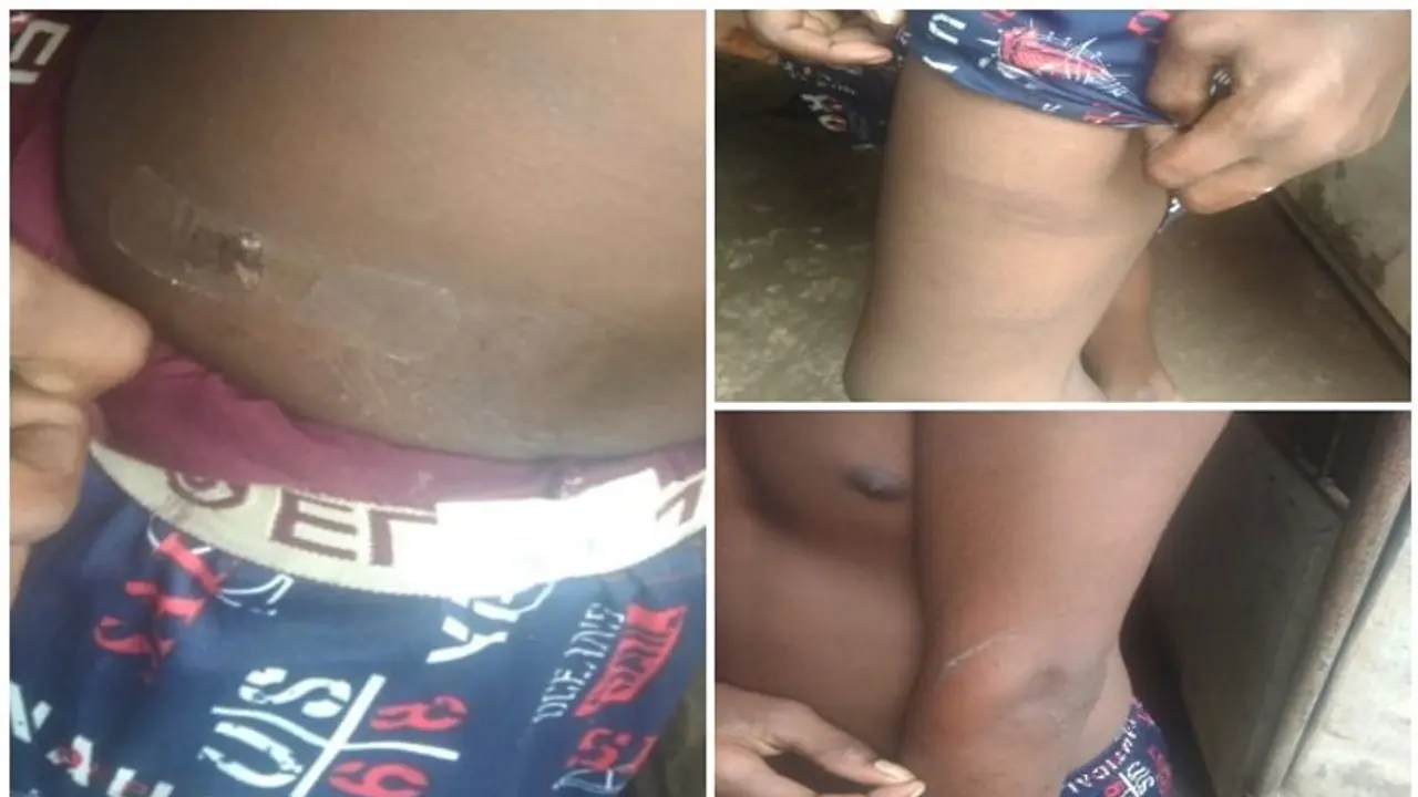 ശ്രീചിത്ര പുവർ ഹോമിൽ 14കാരന് ക്രൂരമർദ്ദനം; സഹപാഠികളായ അഞ്ച് കുട്ടികള് ചേർന്ന് മർദ്ദിച്ചെന്ന് പരാതി ശ്രീചിത്ര പുവർ ഹോമിൽ 14കാരന് ക്രൂരമർദ്ദനം; സഹപാഠികളായ അഞ്ച് കുട്ടികള് ചേർന്ന് മർദ്ദിച്ചെന്ന് പരാതി