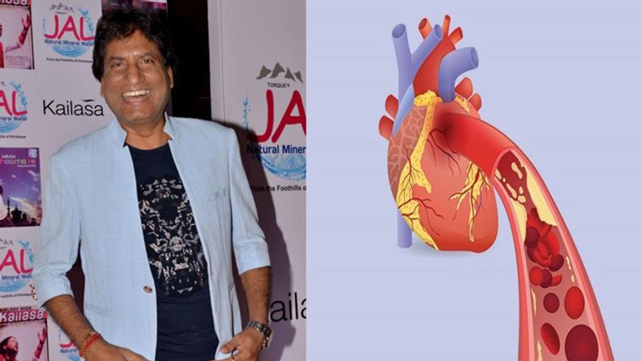 किस बीमारी से 43 दिन तक जंग लड़ रहे थे राजू श्रीवास्तव, जानें इसके लक्षण और कारण किस बीमारी से 43 दिन तक जंग लड़ रहे थे राजू श्रीवास्तव, जानें इसके लक्षण और कारण