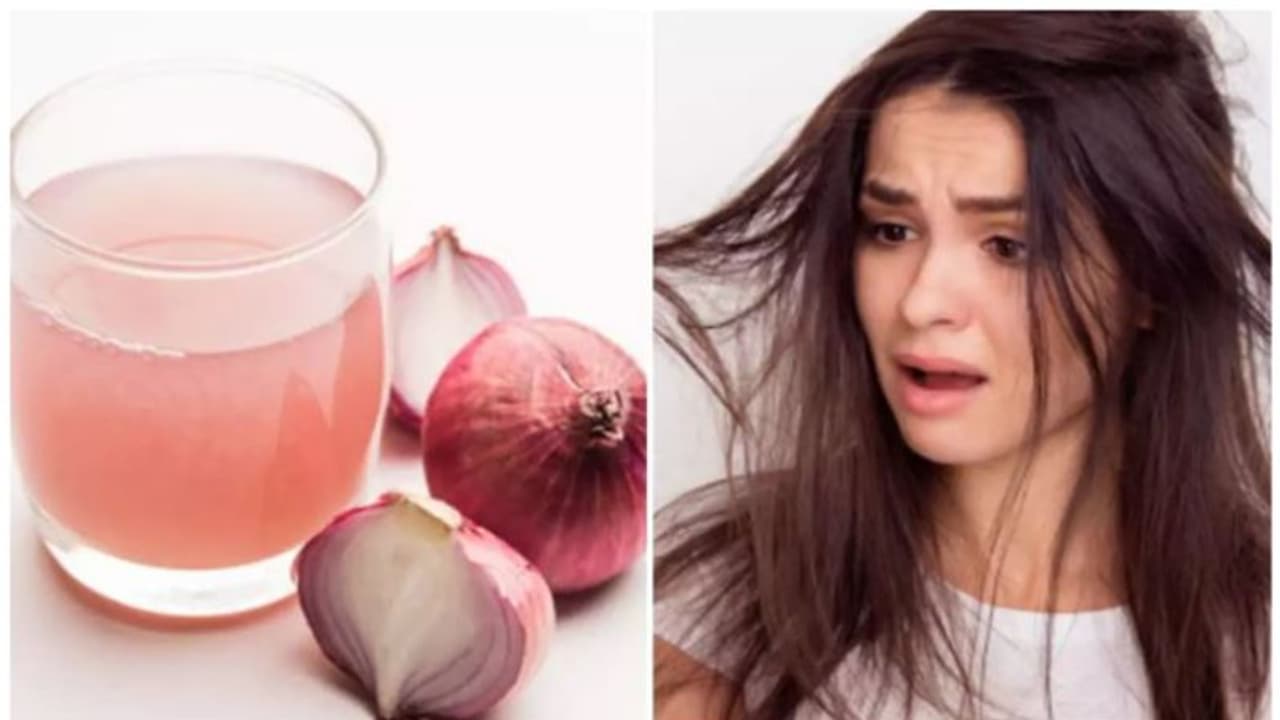 Onion For Hair : മുടികൊഴിച്ചിൽ കുറയ്ക്കാൻ സവാള; ഉപയോഗിക്കേണ്ട വിധം Onion For Hair : മുടികൊഴിച്ചിൽ കുറയ്ക്കാൻ സവാള; ഉപയോഗിക്കേണ്ട വിധം