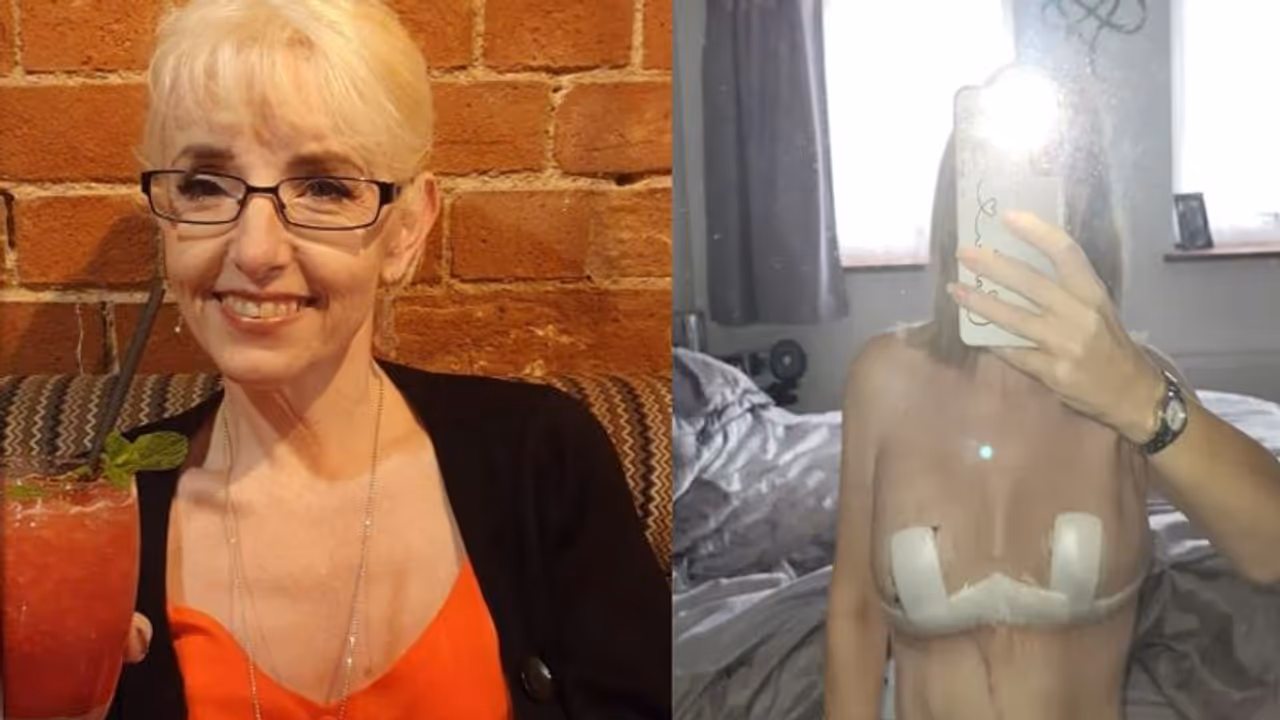 ब्रेस्ट लिफ्ट सर्जरी कराना 53 साल की महिला पर पड़ गया भारी, पैसे भी गंवाई और खूबसूरती भी ब्रेस्ट लिफ्ट सर्जरी कराना 53 साल की महिला पर पड़ गया भारी, पैसे भी गंवाई और खूबसूरती भी