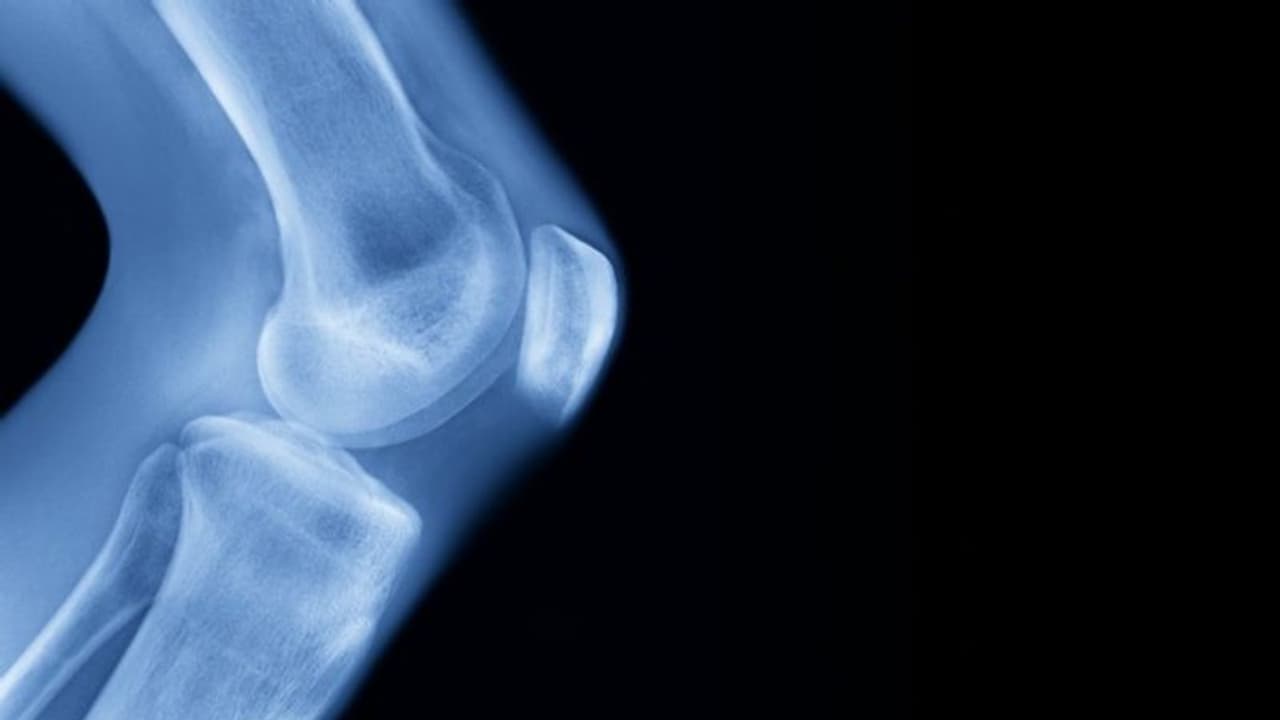 ഉയരം ആറടിയിലധികമാക്കാൻ ശസ്ത്രക്രിയ; ഒടുവിൽ വലിയ തുകയ്ക്ക് കടക്കാരനായി ഒരാള്‍