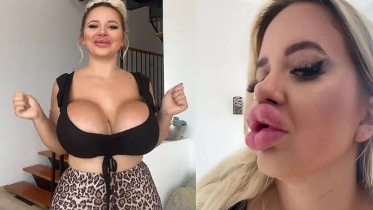 बार्बी जैसी दिखने के लिए 45 लाख किए खर्च, अब ऐसा शरीर लेकर घूम रहीं 21 साल की मैडम बार्बी जैसी दिखने के लिए 45 लाख किए खर्च, अब ऐसा शरीर लेकर घूम रहीं 21 साल की मैडम