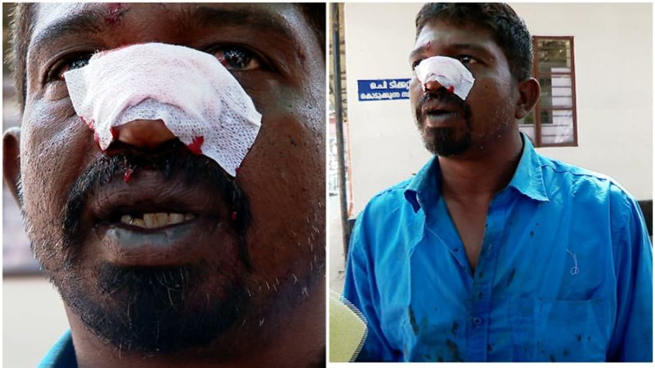 'വലിയ ക്രൂരതയാണ് സാറേ അവര് കാണിക്കുന്നത്', നിർത്തിയിട്ട ലോറിക്ക് നേരെ കല്ലേറ്, ഡ്രൈവറുടെ കണ്ണിൽ ചില്ല് കേറി 'വലിയ ക്രൂരതയാണ് സാറേ അവര് കാണിക്കുന്നത്', നിർത്തിയിട്ട ലോറിക്ക് നേരെ കല്ലേറ്, ഡ്രൈവറുടെ കണ്ണിൽ ചില്ല് കേറി