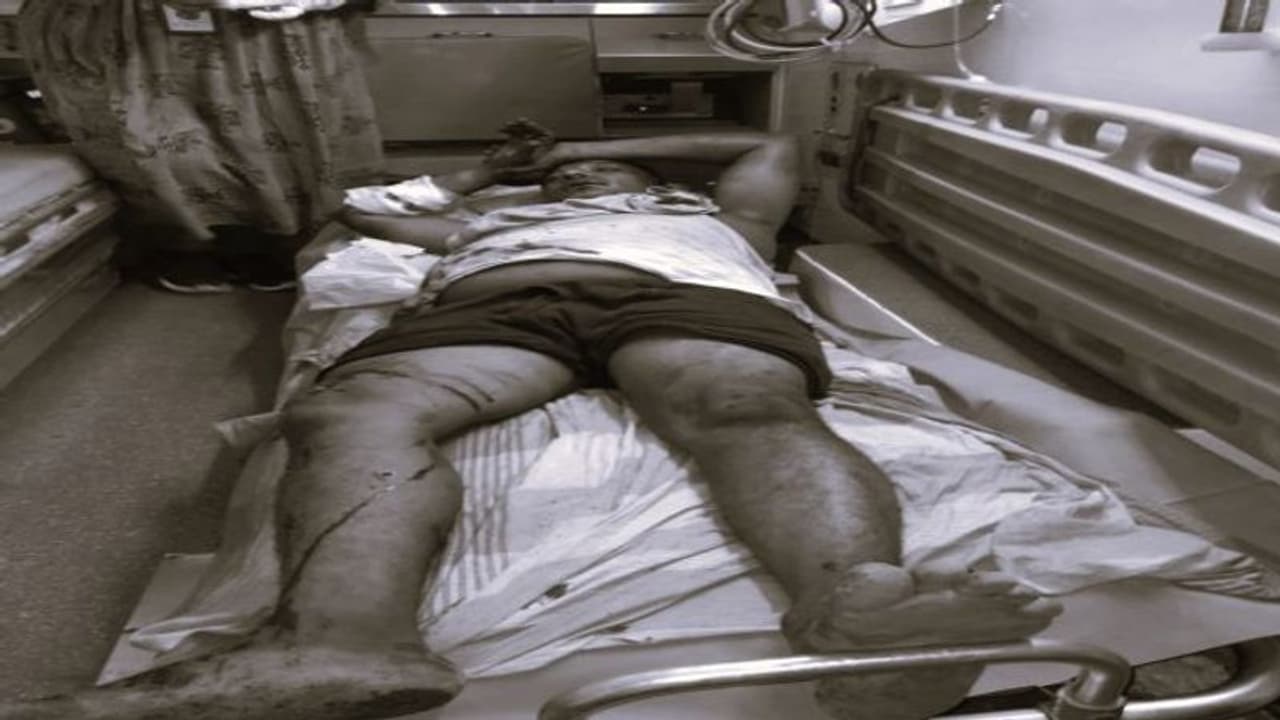 ఎన్టీఆర్ జిల్లాలో బ్లేడ్ బ్యాచ్ అరాచకం... నడిరోడ్డుపై లారీ డ్రైవర్ పై దాడి